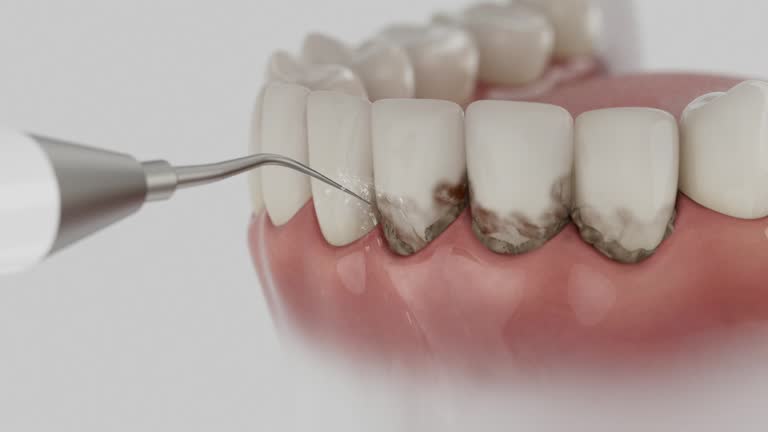 Reliable Dental Implants contractor in Blanchard, OK by Smile Center Dentistry
